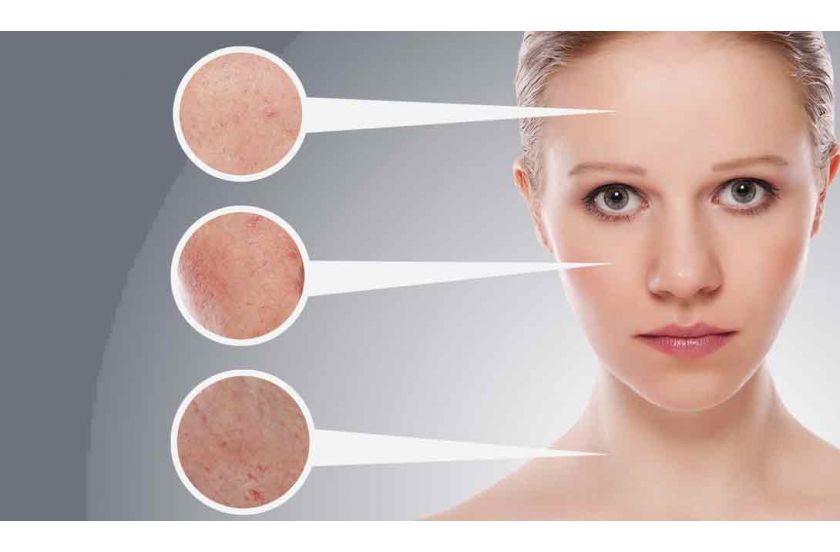 Новий погляд на лікування дерматологічних проблем: NeoTad Glutathione і його дія на шкіру