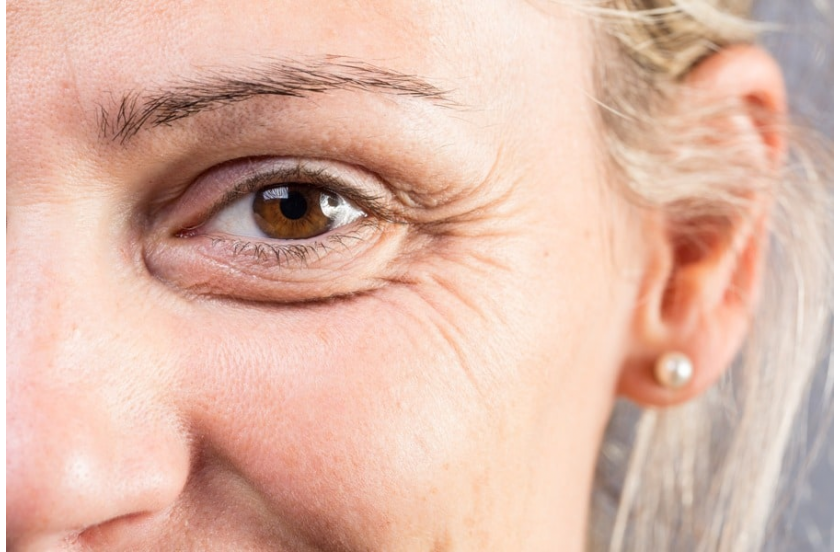 Морщины на лице: как избавиться от них быстро и без инъекций?