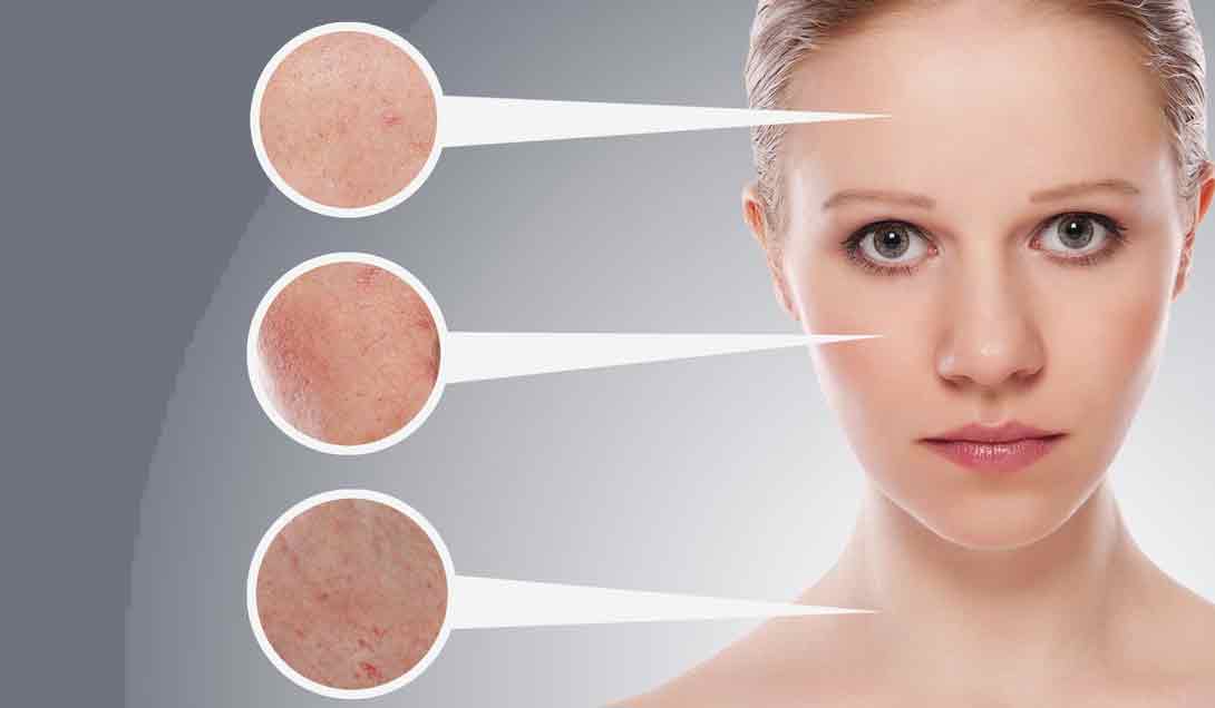 Новий погляд на лікування дерматологічних проблем: NeoTad Glutathione і його дія на шкіру